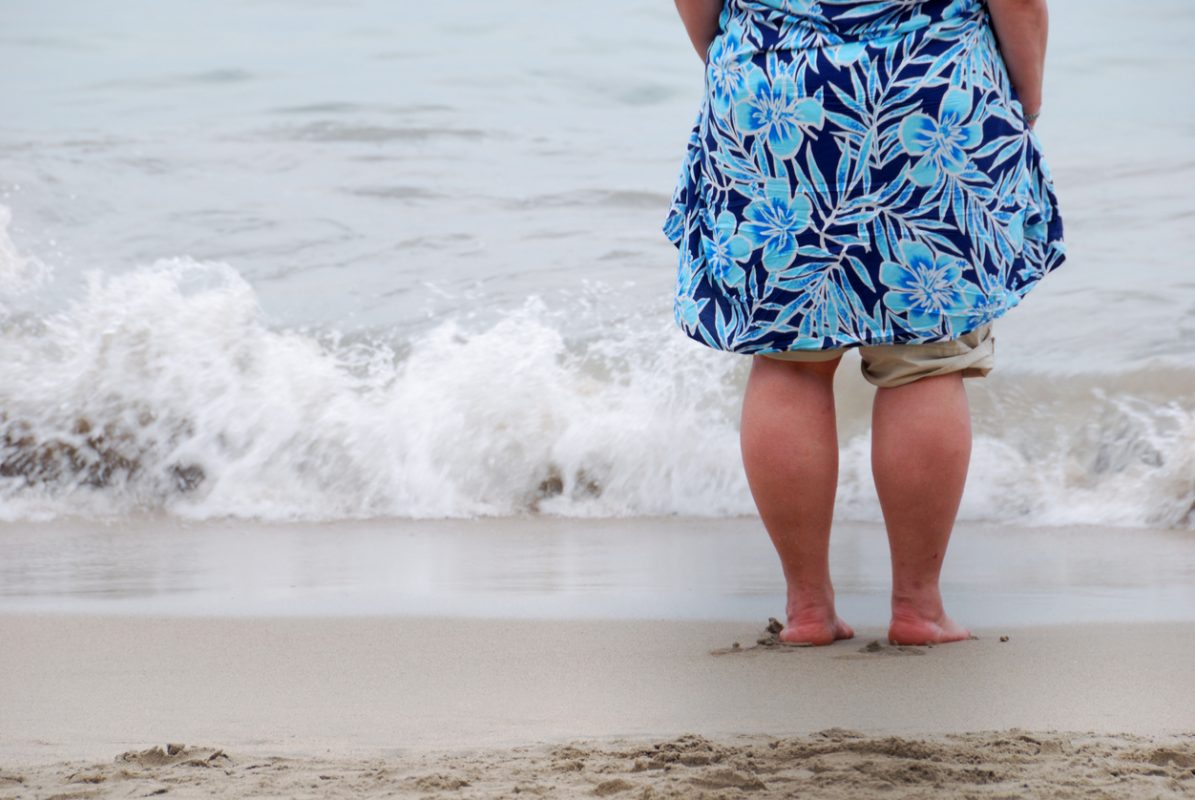 Obesidad y discapacidad