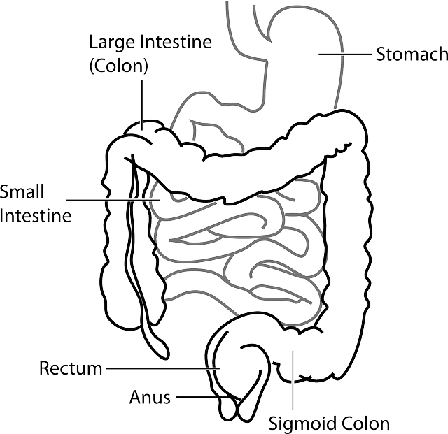 pólipos cáncer de colon
