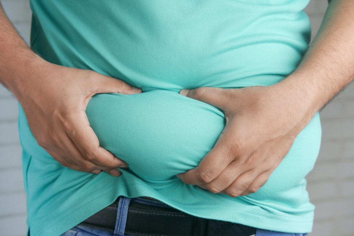 grasa visceral y método apollo y balón gastrico