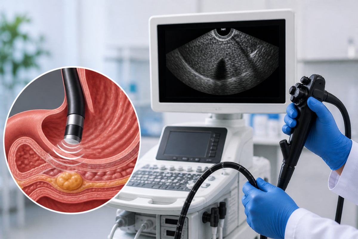Ecoendoscopia digestiva por privado